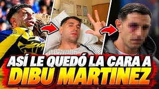 😱 ¡IMPACTANTE! Así le quedó la cara al Dibu Martínez después del tremendo choque