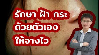 ฝ้าและกระมีลักษณะอย่างไรบ้าง และเกิดจากสาเหตุอะไร