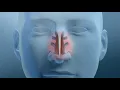 Nasal Turbinate Reduction