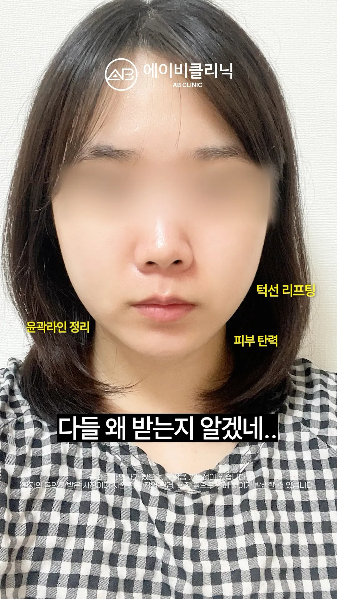 연예인이 하는 관리 저도 받아봤습니다 💕