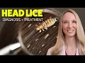 HEAD LICE Diagnosis Treatment Home Remedies Tips from a dermatologist for self treatment