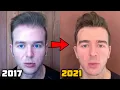 My Current Hair Loss Prevention Protocol