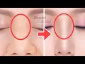 Download Lagu Nose Bridge Lift Massage! Reshape, Sharpen Your Nose, Reduce Fat Nose Without Surgery