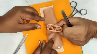 Simutomy- Learn End-to-End Bowel Anastomosis (Type-A) #BowelAnastomosis #InstestineSuturing
