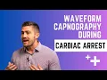 Using Waveform Capnography in Cardiac Arrest