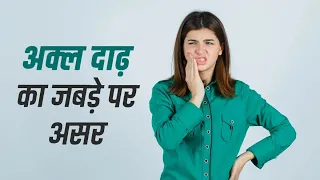 क्या अक्ल दाढ़ निकलने से जबड़े की बनावट बिगड़ सकती है | दांतों और जबड़े पर इसका असर