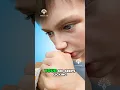 Download Lagu What Does Thumb Sucking Do to kids Teeth 😮  #openbite #shorts  - Creativelearning3d