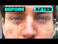 Download Lagu Evidence-Based Routine to Reverse the Signs of Skin Aging
