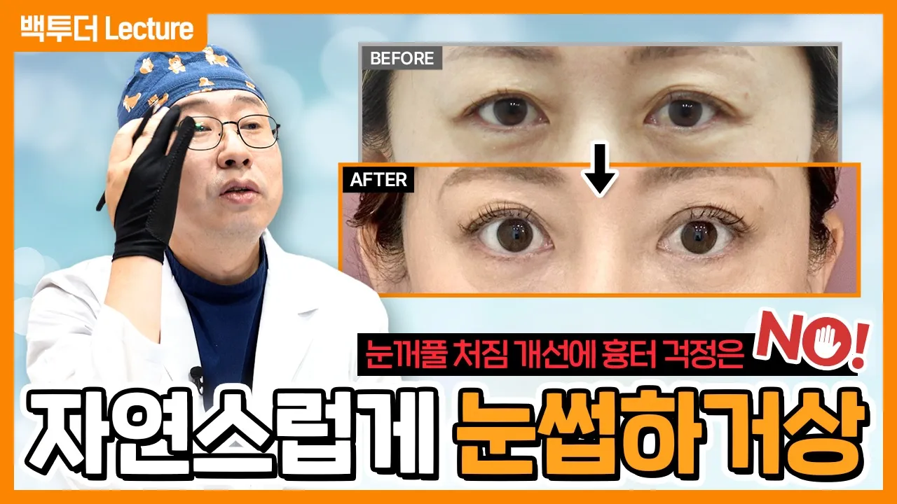 [눈썹하거상] 절개 흉터, 티 난다?┃실제 회복 과정 타임라인 공개!!