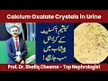 Calcium Oxalate Crystals in Urine Causes Symptoms Treatment