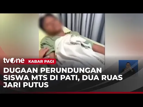 Dua Ruas Jari Putus, Dugaan Perundungan Siswa MTs di Pati Diselidiki Polisi