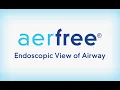 Download Lagu aerFree: Endoscopic View of Airway