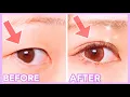 Create Double Eyelid Without Surgery Make Your Eyes Bigger Naturally