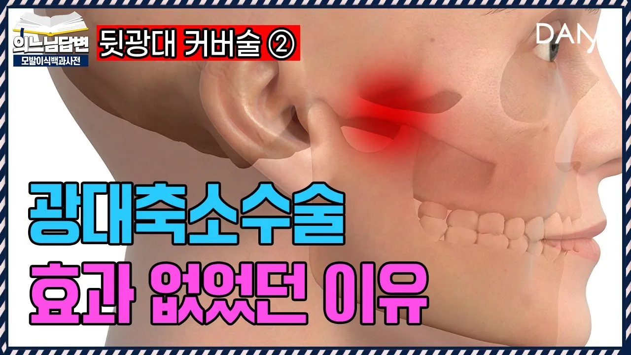 의느님답변📂광대 축소 수술을 해도 효과가 없었던 이유ㅣ뒷광대 커버술②ㅣ다나성형외과(DANA)ㅣ모발이식ㅣ헤어라인교정ㅣ두피문신ㅣ탈모치료