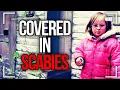 Download Lagu Mom Lets Disabled Daughter Get Devoured By Scabies