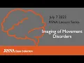 RCC Lecture Series Imaging of Movement Disorders