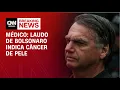 Download Lagu Laudo de Bolsonaro indica câncer de pele, explica médico | BASTIDORES CNN