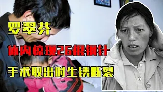 农妇体内惊现26根钢针!手术取出时生锈断裂,幕后黑手竟是至亲