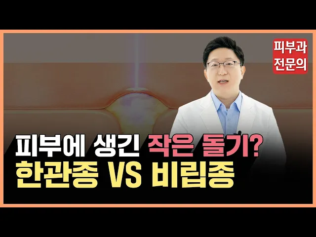 얼굴에 오톨도톨한 무언가 생겼다면? (한관종, 비립종 정확히 구분하기)