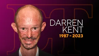 Darren Kent Game of Thrones Actor Dead at 36