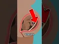 Download Lagu Anterior Placenta Risk #pregnancy