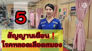 ทำไมการมาโรงพยาบาลเร็วเมื่อมีอาการหลอดเลือดสมองจึงสำคัญ