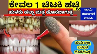 ಒಂದು ಚಿಟಕಿ ಹಚ್ಚಿ - ಹುಳ ಹಿಡಿದ ಹಳದಿ ಹಲ್ಲು ಮತ್ತೆ ಹೊಸದಾಗಿ ಮಾಡುತ್ತೆ ಹಲ್ಲು ನೋವು ನಿಮಿಷದಲ್ಲಿ ಮಾಯ