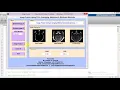 Medical Image Fusion using PCA Matlab Project Code