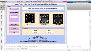 Medical Image Fusion using PCA Matlab Project Code