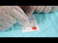 Where to get coronavirus antibody testing in the Sacramento region