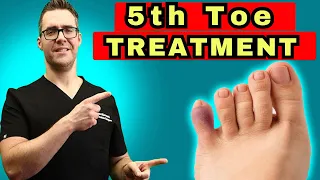 Download What To Do For A Broken Pinky Toe [How To Tape \u0026 Little Toe Treatment] MP3