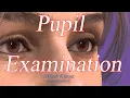 Pupil Examination RAPD Pupillary Light Reflex Marcus Gunn Pupil Swinging flashlight Test