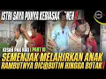 Download Lagu TAK PERCAYA TAPI NYATA❗️WANITA INI MENCABUTI RAMBUTNYA SATU PERSATU SAMPAI BOTAK❗️