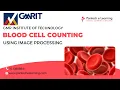 Blood Cell Counting Using Image Processing