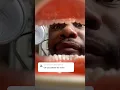 Download Lagu Victor’s Dental ASMR Appointment Gone Wrong | Doctor Hard Loses His Teeth 🦷