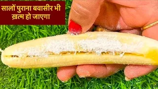 दिन में सिर्फ एक बार ये करलो बवासीर हो या भगंदर या हो फिशर सबको जड़ से खत्म करो  Treatment for Piles