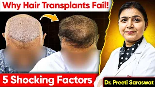 5 Shocking Factors That Can Cause Your Hair Transplant to Fail – Dr. Preeti Saraswat Reveals!