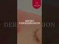 Microdermabrasion