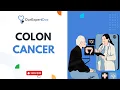 What is Colon Cancer How can you sign up for a consultation https ourexpertdoc com