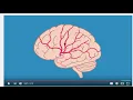 Introduction to Stroke