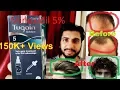 Tugain 5 Solution Minoxidil 5 For Hair Regrowth Review in Hindi Hair Loss Treatment India