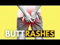 Butt Rashes What You Need to Know