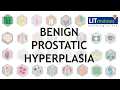 Benign Prostatic Hyperplasia
