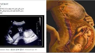 هوا ده احساس الحمل اثناء المباشره في نفس الوقت 