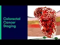 Lagu Colorectal Cancer Staging