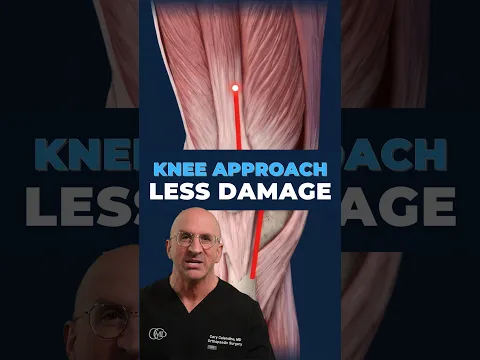 Why I Sometimes Choose the Traditional Knee Replacement Approach
