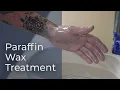 Paraffin Wax Therapy in Post-Op Hand Rehabilitation