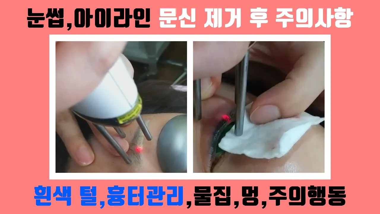 눈썹,아이라인 반영구 문신 제거 후 주의사항 (흰색 털,흉터 관리,물집,멍,주의 행동,화장,세안 및 샤워)