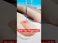 Download Lagu Je vingernagel boren?! Als je je teen stoot 🔨🦶 Subungaal hematoom uitgelegd #shorts #wetenschap #...
