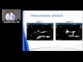 3D and Interventional Echo Stephen Little MD January 17 2017